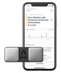 Personal EKG Device and Heart Monitor F368