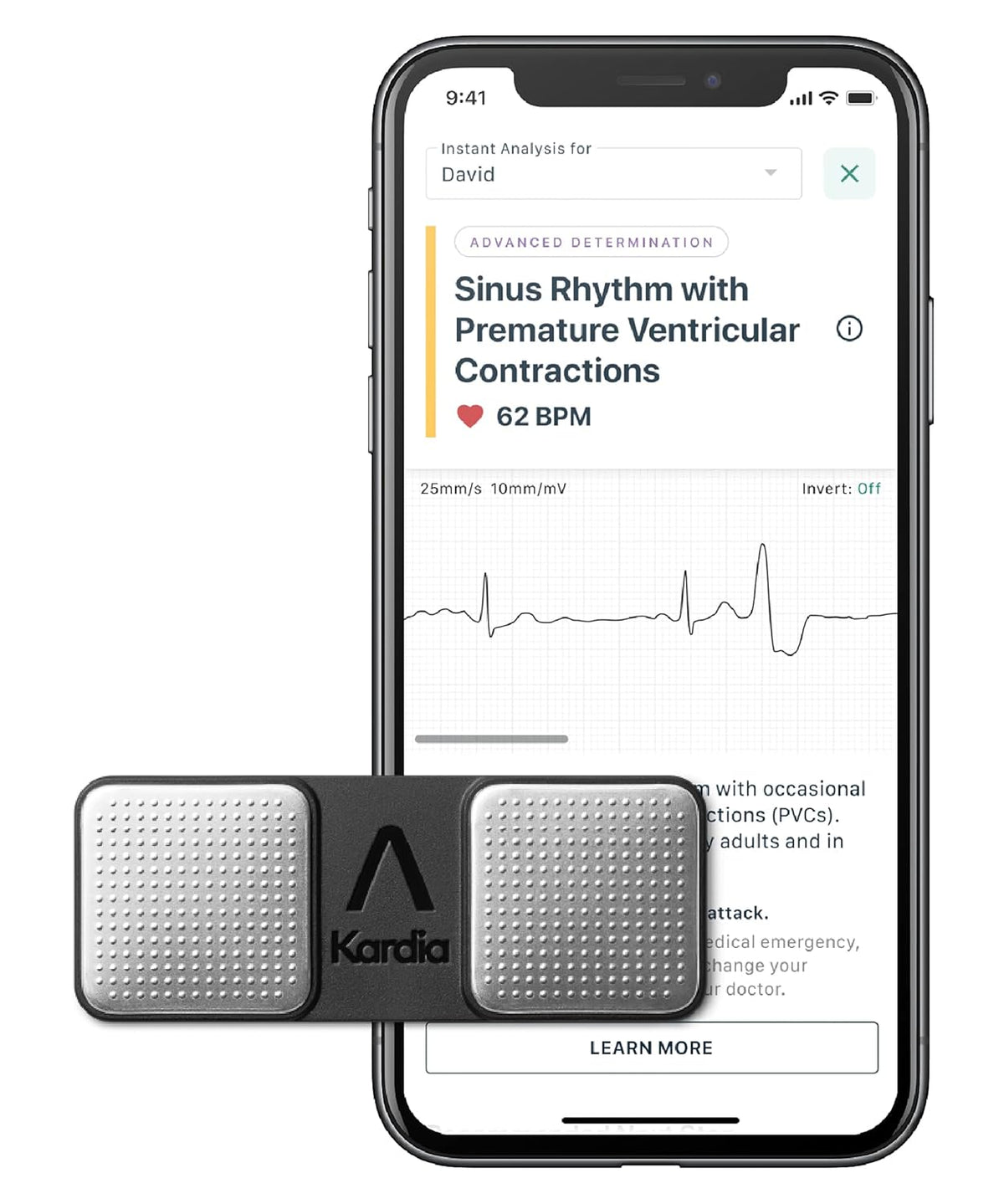 Personal EKG Device and Heart Monitor F368